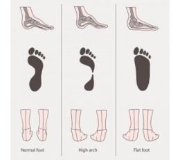 How to prevent flat feet