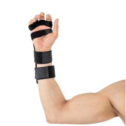 W350 radial nerve splint